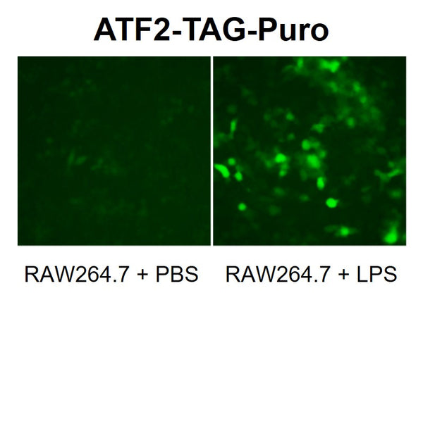 ATF2 Reporter Lentivirus – Figure 1