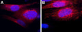 Anti-TRHR1 Antibody