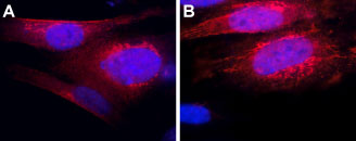 Anti-TRHR1 Antibody