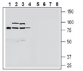 ZnT10 (SLC30A10) Blocking Peptide