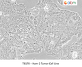 Ham-2 Tumor Cell Line | Applied Biological Materials (abm)