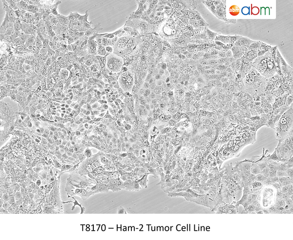 Ham-2 Tumor Cell Line | Applied Biological Materials (abm)