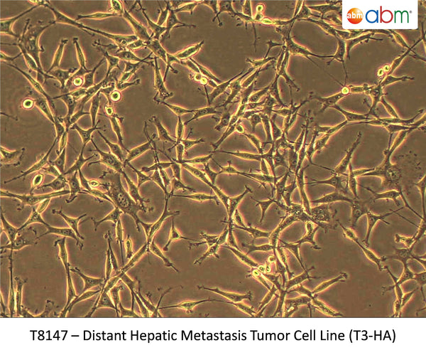 Distant Hepatic Metastasis Tumor Cell Line (T3-HA) | Applied Biological Materials (abm)