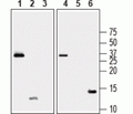 Recombinant human BDNF proDomain protein