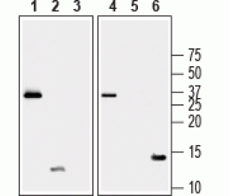Recombinant human BDNF proDomain protein