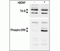 Recombinant human BDNF protein