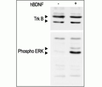 Recombinant human BDNF protein