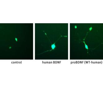 Recombinant human proBDNF protein