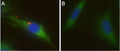 Brefeldin A – Figure 1 of 3