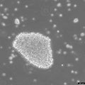 B-LCL-CDG1 cell