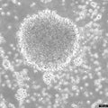B-LCL-CDG3 cell