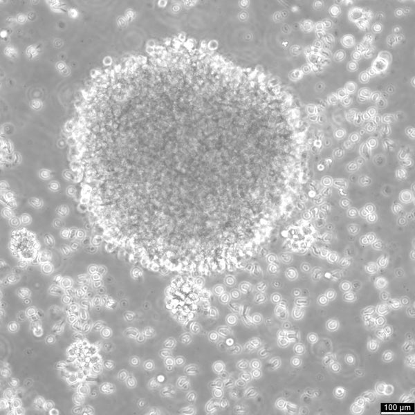 B-LCL-CDG3 cell