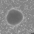 B-LCL-CDG5 cell