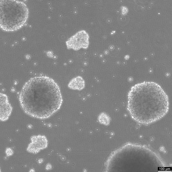 B-LCL-HROC112 cell