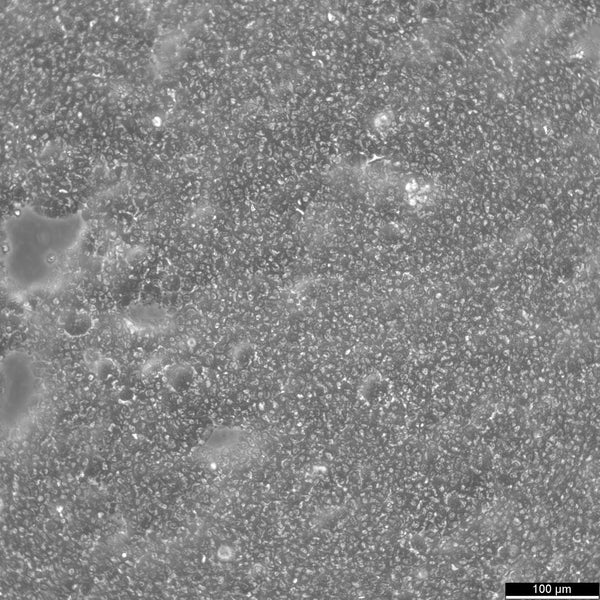 B-LCL-HROC285 cell