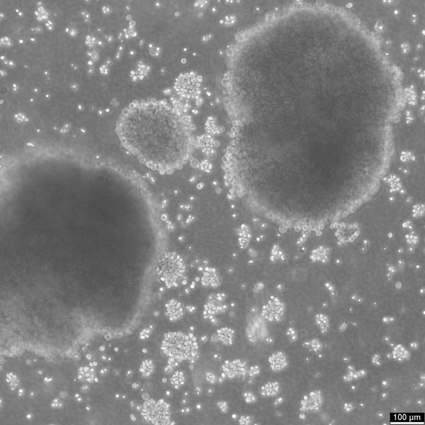 B-LCL-HROC69 cell