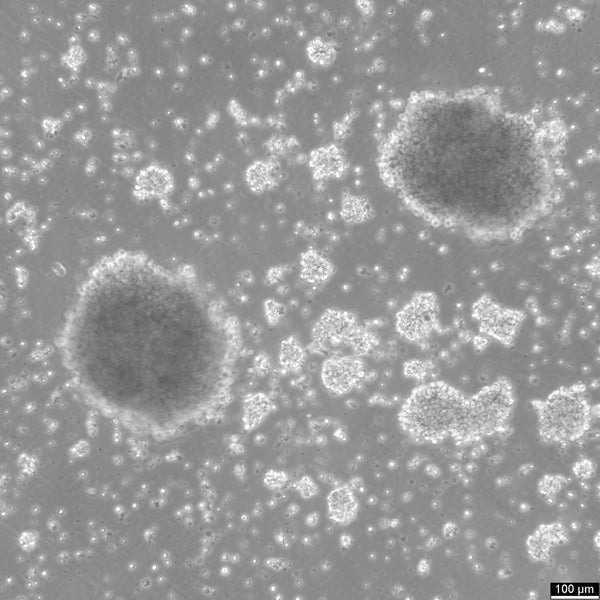 B-LCL-HROC72 cell