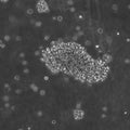 B-LCL-HROG04 cell
