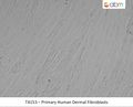 Primary Human Dermal Fibroblasts | Applied Biological Materials (abm)
