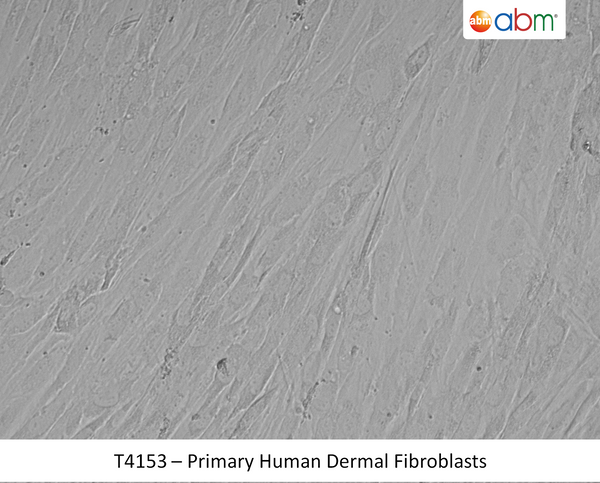 Primary Human Dermal Fibroblasts | Applied Biological Materials (abm)