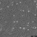 BJ Fibroblast cell