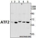 Western blot (WB) analysis of ATF2 (G56) polyclonal antibody at 1:500 dilution
Lane1:The Brain tissue lysate of Mouse(40ug)
Lane2:The Brain tissue lysate of Rat(40ug)
Lane3:AML-12 whole cell lysate(40ug)
Lane4:L02 whole cell lysate(40ug)
Lane5:MCF-7 whole cell lysate(40ug)
