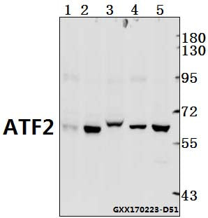 Western blot (WB) analysis of ATF2 (G56) polyclonal antibody at 1:500 dilution
Lane1:The Brain tissue lysate of Mouse(40ug)
Lane2:The Brain tissue lysate of Rat(40ug)
Lane3:AML-12 whole cell lysate(40ug)
Lane4:L02 whole cell lysate(40ug)
Lane5:MCF-7 whole cell lysate(40ug)