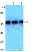 Western blot (WB) analysis of ATF2 (V65) polyclonal antibody at 1:500 dilution
Lane1:Hela cell lysate
Lane2:Mouse kidney tissue lysate
Lane3:Rat brain tissue lysate