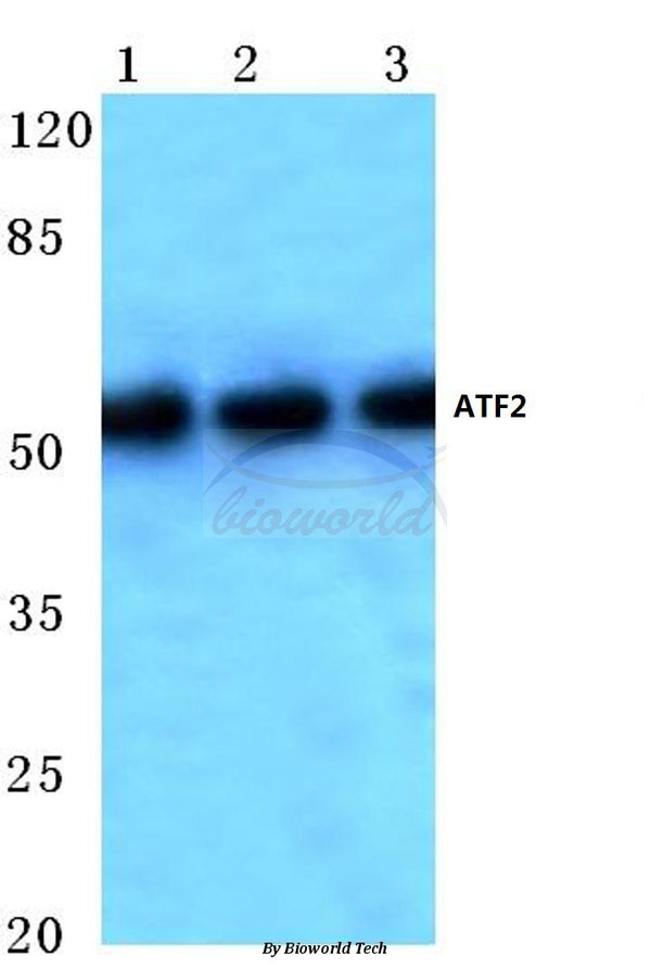 Western blot (WB) analysis of ATF2 (V65) polyclonal antibody at 1:500 dilution
Lane1:Hela cell lysate
Lane2:Mouse kidney tissue lysate
Lane3:Rat brain tissue lysate