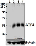 Western blot (WB) analysis of ATF4 pAb at 1:5000 dilution
Lane1:EC9706 whole cell lysate(40ug)
Lane2:C6 whole cell lysate(40ug)
Lane3:A375 whole cell lysate(40ug)
Lane4:3T3-L1 whole cell lysate(40ug)