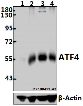 Western blot (WB) analysis of ATF4 pAb at 1:5000 dilution
Lane1:EC9706 whole cell lysate(40ug)
Lane2:C6 whole cell lysate(40ug)
Lane3:A375 whole cell lysate(40ug)
Lane4:3T3-L1 whole cell lysate(40ug)