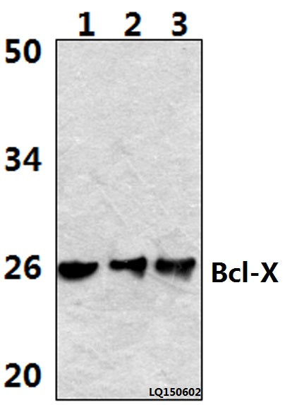 Western blot (WB) analysis of Bcl-X (S56) polyclonal antibody at 1:500 dilution
Lane1:Hela whole cell lysate(40ug)
Lane2:Hela treated with H2O2 (100nmol/ml, 25min, phostop) whole cell lysate (40ug) 
Lane3:Hela treated with H2O2 (100nmol/ml, 25min, λ-ppase) whole cell lysate (40ug)