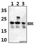 Western blot (WB) analysis of BIK (M27) polyclonal antibody at 1:500 dilution
Lane1:HEK293T whole cell lysate(40ug)
Lane2:H9C2 whole cell lysate(40ug)
Lane3:RAW264.7 whole cell lysate(40ug)