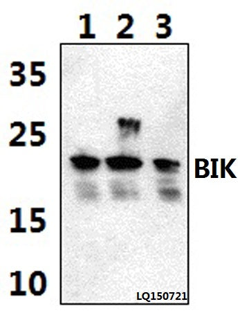 Western blot (WB) analysis of BIK (M27) polyclonal antibody at 1:500 dilution
Lane1:HEK293T whole cell lysate(40ug)
Lane2:H9C2 whole cell lysate(40ug)
Lane3:RAW264.7 whole cell lysate(40ug)