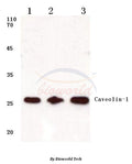 Western blot (WB) analysis of Caveolin-1 (V163) polyclonal antibody at 1:500 dilution
Lane1:A549 cell lysate
Lane2:Mouse kidney tissue lysate
Lane3:Rat kidney tissue lysate