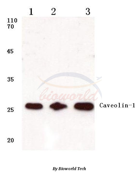 Western blot (WB) analysis of Caveolin-1 (V163) polyclonal antibody at 1:500 dilution
Lane1:A549 cell lysate
Lane2:Mouse kidney tissue lysate
Lane3:Rat kidney tissue lysate