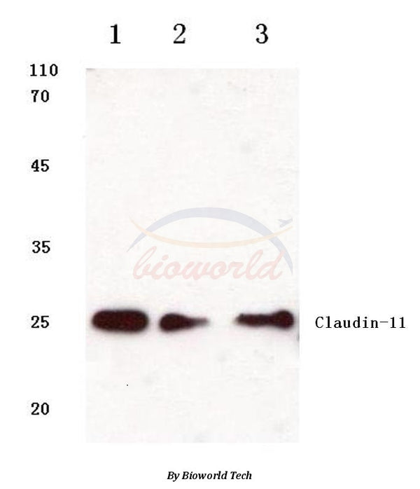 Western blot (WB) analysis of Claudin-11 (S198) polyclonal antibody at 1:500 dilution
Lane1:Hela cell lysate
Lane2:Raw264.7 cell lysate
Lane3:Rat heart tissue lysate
