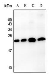 Claudin-3 (T204) polyclonal antibody – Figure 1 of 3