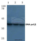 Western blot (WB) analysis of DNA pol β (Q324) polyclonal antibody at 1:500 dilution
Lane1:Hela cell lysate
Lane2:sp2/0 cell lysate
Lane3:Rat brain tissue lysate