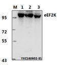 Western blot (WB) analysis of eEF2K (P360) polyclonal antibody at 1:1000 dillution
Lane1:Hela whole cell lysate(40μg)
Lane2:HCT-116 whole cell lysate(40μg)
Lane3:C6 whole cell lysate(60μg)