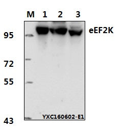 Western blot (WB) analysis of eEF2K (P360) polyclonal antibody at 1:1000 dillution
Lane1:Hela whole cell lysate(40μg)
Lane2:HCT-116 whole cell lysate(40μg)
Lane3:C6 whole cell lysate(60μg)