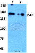 Western blot (WB) analysis of EGFR (S1064) polyclonal antibody at 1:500 dilution
Lane1:MCF-7 cell lysate
Lane2:sp2/0 cell lysate