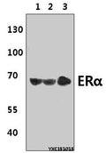 Western blot (WB) analysis of ERα (L100) polyclonal antibody at 1:500 dillution
Lane1:MCF-7 whole cell lysate(40μg)
Lane2:NIH-3T3 whole cell lysate(40μg)
Lane3:H9C2 whole cell lysate(40μg)
