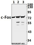 Western blot (WB) analysis of c-Fos (F3) polyclonal antibody at 1:500 dilution
Lane1:A549 whole cell lysate(40ug)
Lane2:HEK293T whole cell lysate(40ug)
Lane3:SK-OVCAR3 whole cell lysate(40ug)