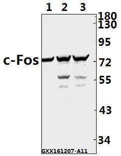 Western blot (WB) analysis of c-Fos (F3) polyclonal antibody at 1:500 dilution
Lane1:A549 whole cell lysate(40ug)
Lane2:HEK293T whole cell lysate(40ug)
Lane3:SK-OVCAR3 whole cell lysate(40ug)