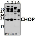 Western blot (WB) analysis of CHOP (K121) pAb at 1:500 dilution
Lane1:A375 whole cell lysate(40ug)
Lane2:HCT116 whole cell lysate(40ug)
Lane3:The Kidney tissue lysate of Mouse(40ug)
Lane4:PC12 whole cell lysate(40ug)