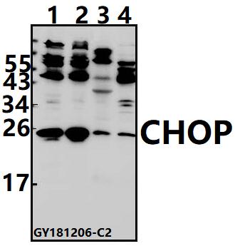 Western blot (WB) analysis of CHOP (K121) pAb at 1:500 dilution
Lane1:A375 whole cell lysate(40ug)
Lane2:HCT116 whole cell lysate(40ug)
Lane3:The Kidney tissue lysate of Mouse(40ug)
Lane4:PC12 whole cell lysate(40ug)