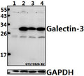 Western blot (WB) analysis of Galectin-3 (N174) polyclonal antibody at 1:500 dilution
Lane1:THP-1 whole cell lysate(40ug)
Lane2:L02 whole cell lysate(40ug)
Lane3:HCT116 whole cell lysate(40ug)
Lane4:HepG2 whole cell lysate(40ug)