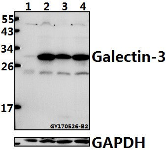 Western blot (WB) analysis of Galectin-3 (N174) polyclonal antibody at 1:500 dilution
Lane1:THP-1 whole cell lysate(40ug)
Lane2:L02 whole cell lysate(40ug)
Lane3:HCT116 whole cell lysate(40ug)
Lane4:HepG2 whole cell lysate(40ug)