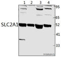Western blot (WB) analysis of SLC2A1 polyclonal antibody at 1:500 dilution
Lane1:PC12 whole cell lysate(40ug)
Lane2:SGC7901 whole cell lysate(40ug)
Lane3:EC9706 whole cell lysate(40ug)